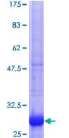 Human ANXA9 Protein (Recombinant GST, N-terminus)
