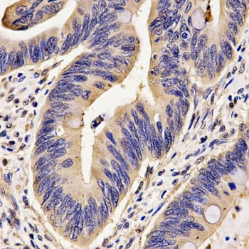 IHC-plus™ Polyclonal Rabbit anti-Human FKBP1A / FKBP12 Antibody (IHC, WB)