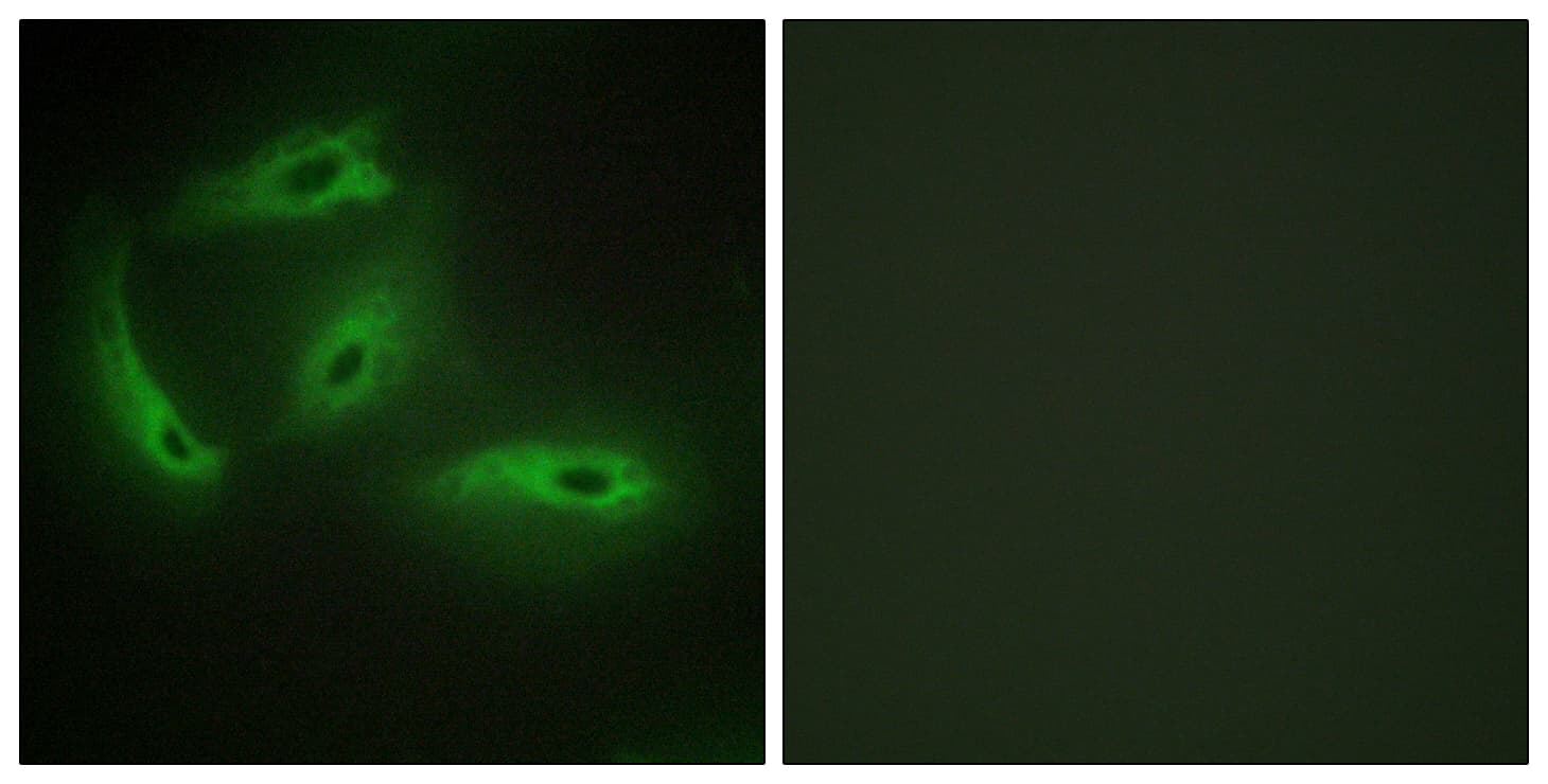 CDKL4 Antibody (aa266-315)