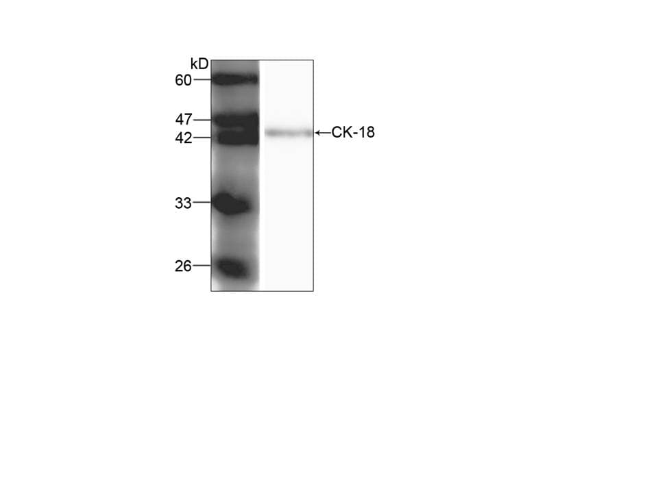 Monoclonal Mouse anti-Human KRT18 / CK18 / Cytokeratin 18 Antibody (IHC, WB)