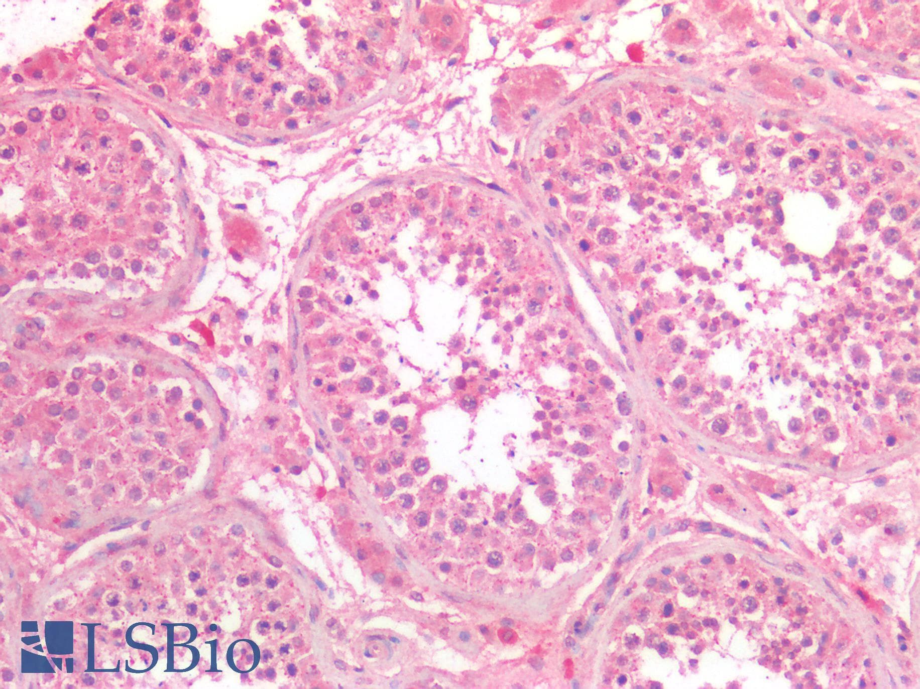 PathPlus™ Osteonectin / SPARC Antibody