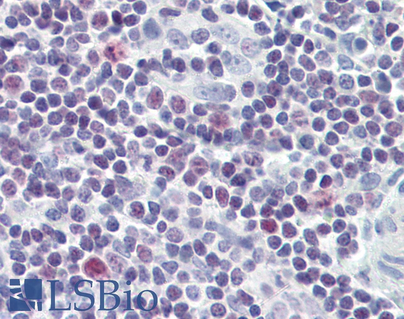 PathPlus™ Polyclonal Rabbit anti-Human BIRC5 / Survivin Antibody (aa86-135, IHC, IF, WB)