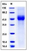 Human CD19 Protein (Recombinant His,C-terminus)