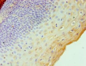 Polyclonal Rabbit anti-Human STAT4 Antibody (aa569-748, IHC, WB)