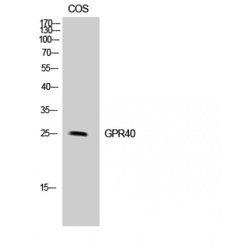 FFAR1 / GPR40 Antibody (160-240 aa, Internal)