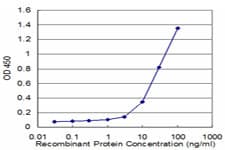 Monoclonal Mouse anti-Human PCYT1A / CCT Alpha Antibody (clone 6E6, WB)