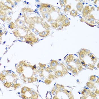 Polyclonal Rabbit anti-Human COQ7 Antibody (IHC, WB)