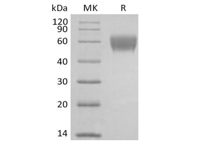 Cynomolgus Gb:x54870_rna1 Nkg2-d Type II Integral Membrane Protein (HUMAN);contains Alu Repetitive Element;contains Element Mer33 Repetitive Element ; (Recombinant Fc, N-terminus)
