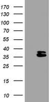 OTUB1 / OTU1 Antibody (clone OTI1A6)