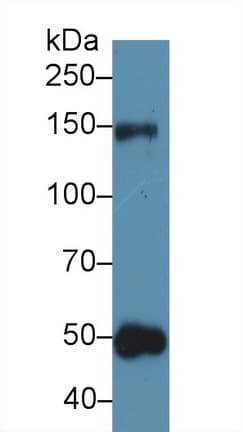 THBS1 / Thrombospondin-1 Antibody (aa71-259)