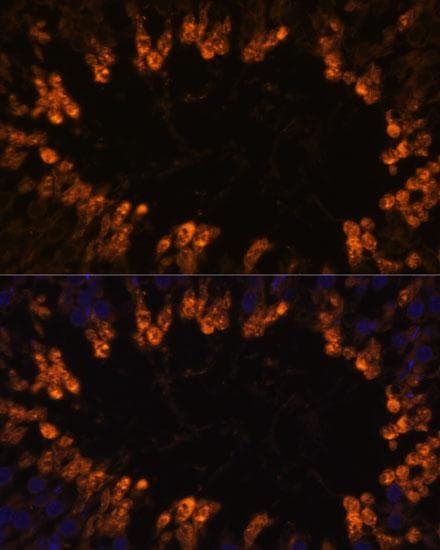 OXCT2 Antibody