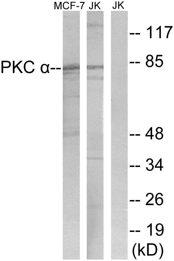 Polyclonal Rabbit anti-Human PRKCA / PKC-Alpha Antibody (p657, WB)