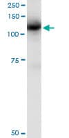 Monoclonal Mouse anti-Human c-CBL Antibody (clone 6D12, WB)