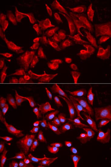 Polyclonal Rabbit anti-Human BCL2L13 / Bcl Rambo Antibody (IHC, IF, WB)