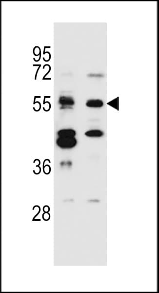 IHC-plus™ CELF3 Antibody (aa3-32)