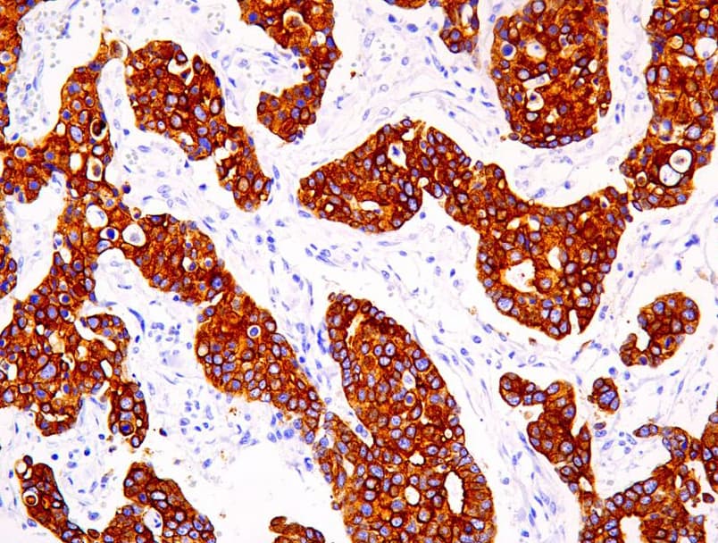 KRT18 / CK18 / Cytokeratin 18 Antibody (clone AHC0095)