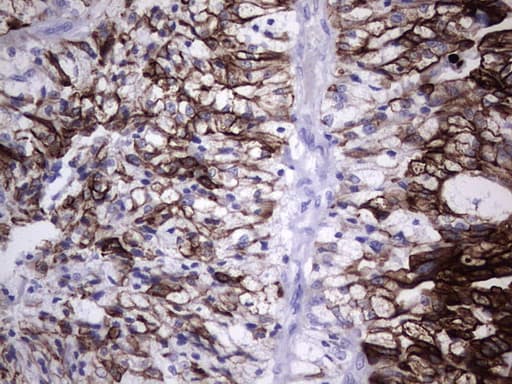 KRT19 / CK19 / Cytokeratin 19 Antibody (aa240-390, clone OTI3D10)