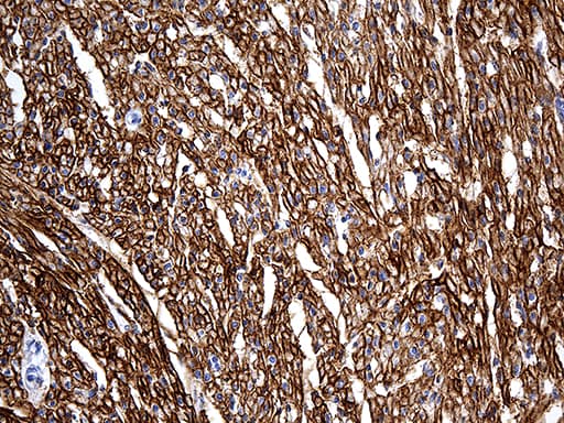 SGCD / Delta-Sarcoglycan Antibody (aa66-290, clone OTI3D9)