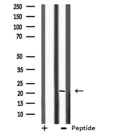 SLC9A1BP / CHP Antibody