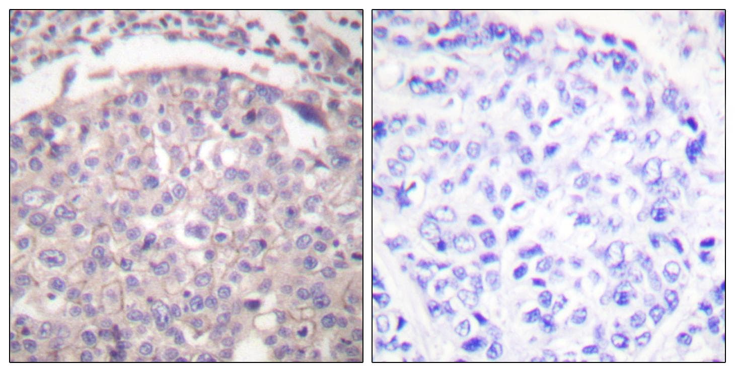 XRCC6 / Ku70 Antibody (p5)