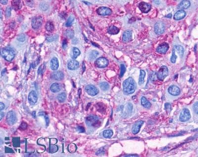 PathPlus™ FPR2 / FPRL1 Antibody (C-Terminus)