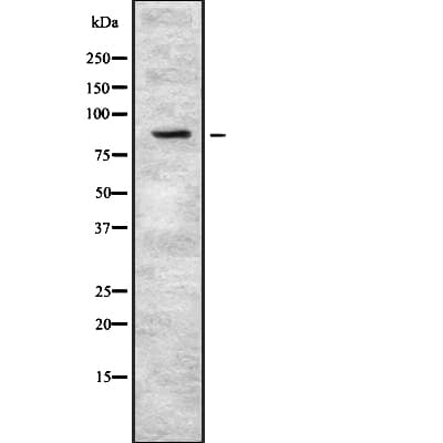 Polyclonal Rabbit anti-Human PKP3 / Plakophilin 3 Antibody (IHC, WB)