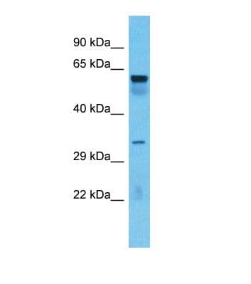 Polyclonal Rabbit anti-Human TOX4 / C14orf92 Antibody (C-Terminus, WB)