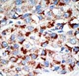 UBA3 / UBE1C Antibody (aa415-445)