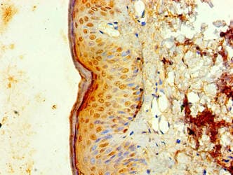 IL1F10 Antibody (aa1-152)