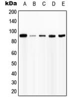 Polyclonal Rabbit anti-Human CD119 / IFNGR1 Antibody (phospho-Tyr457, WB)