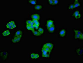 ADGRB2 / BAI2 Antibody