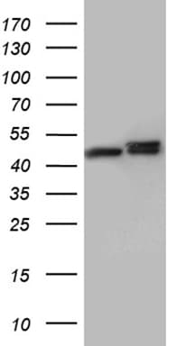 Monoclonal Mouse anti-Human HNRNPH1 / hnRNP H Antibody (clone OTI4F10, Carrier-free, IHC, WB)