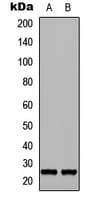 FGF17 Antibody (C-Terminus)