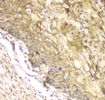 Polyclonal Rabbit anti-Human MCUR1 / CCDC90A Antibody (IHC, WB)