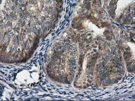 RGS16 Antibody (clone OTI1D3)