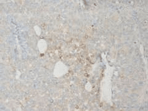 ITGB2 / CD18 Antibody (aa24-54)