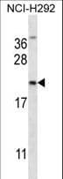 IHC-plus™ Polyclonal Rabbit anti-Human EMA / MUC1 Antibody (aa1176-1205, IHC, WB)