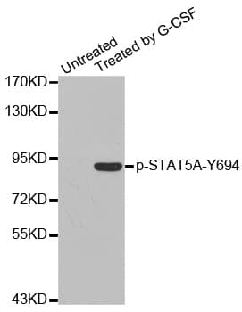 STAT5A Antibody (phospho-Tyr694)