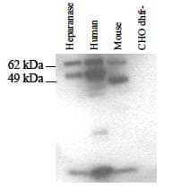 IHC-plus™ Polyclonal Rabbit anti-Human HPSE / Heparanase Antibody (IHC, WB)