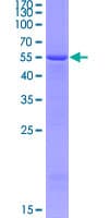 Human FBLN4 / EFEMP2 Protein (Recombinant GST)