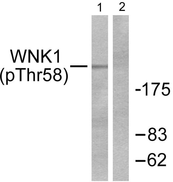Polyclonal Rabbit anti-Human WNK1 Antibody (phospho-Thr58, IHC, WB)