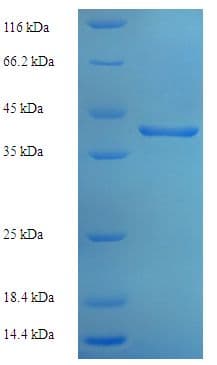 Human POP4 Protein (Recombinant His-SUMO)