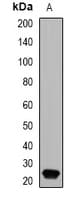 IHC-plus™ Polyclonal Rabbit anti-Human GPX4 / MCSP Antibody (IHC, IF, WB)