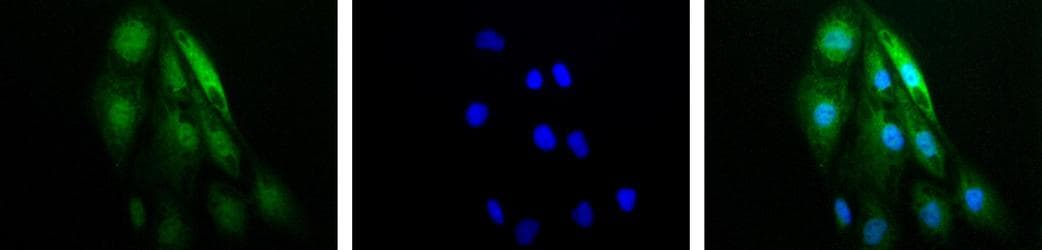 HIF1A / HIF1 Alpha Antibody (aa530-825, DY650)