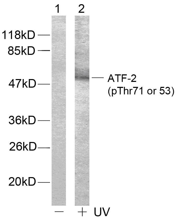 Polyclonal Rabbit anti-Human ATF2 Antibody (phospho-Thr71 or 53, IHC, WB)