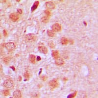 Polyclonal Rabbit anti-Human ST6GAL1 / CD75 Antibody (Internal, IHC, WB)