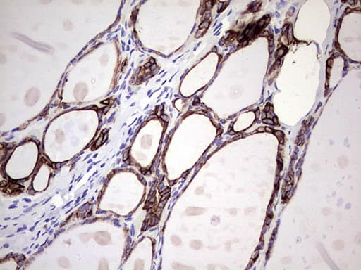 KRT7 / CK7 / Cytokeratin 7 Antibody (aa1-114, clone UMAB161)