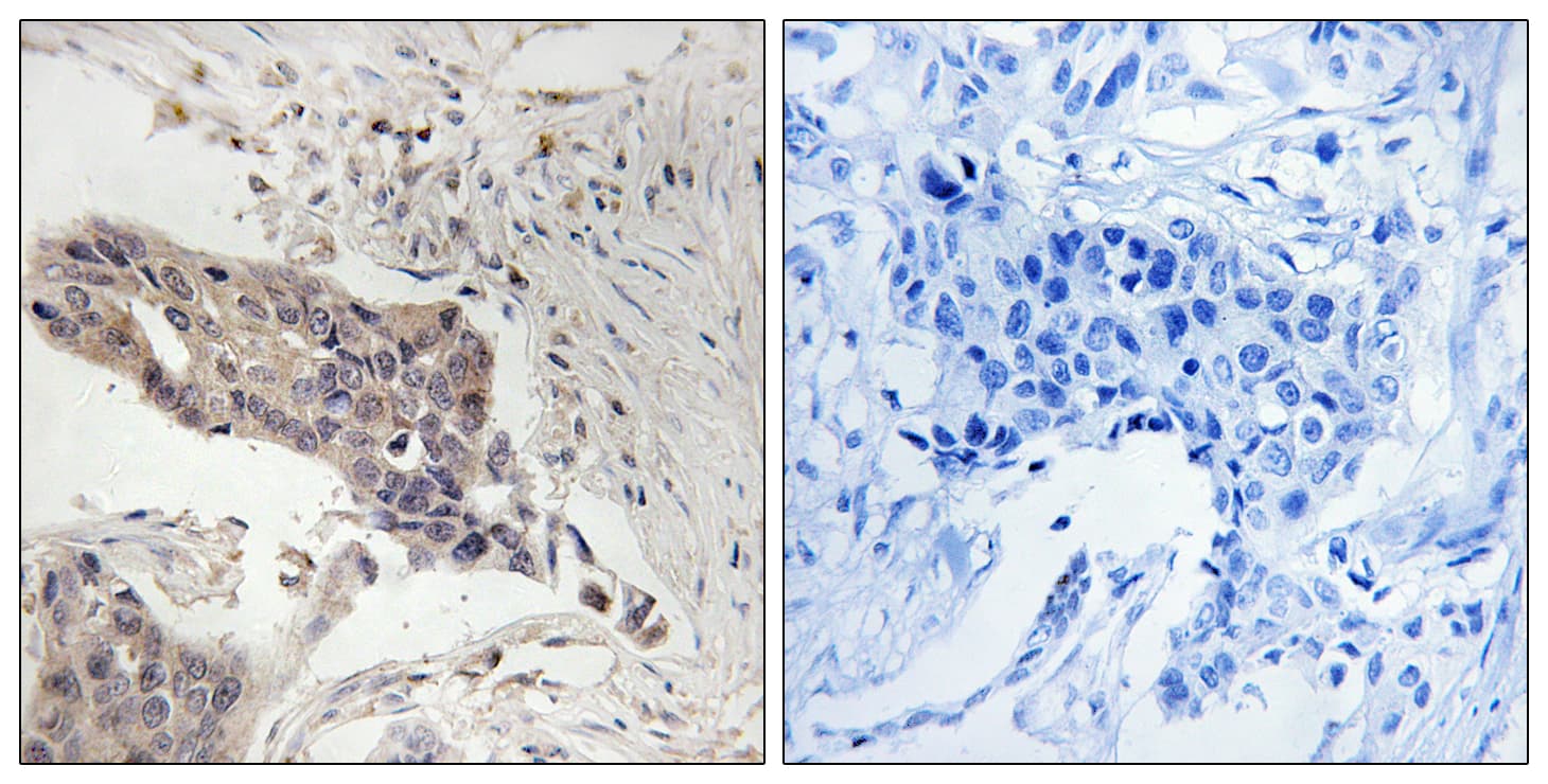 LCP2 / SLP-76 Antibody (aa94-143)