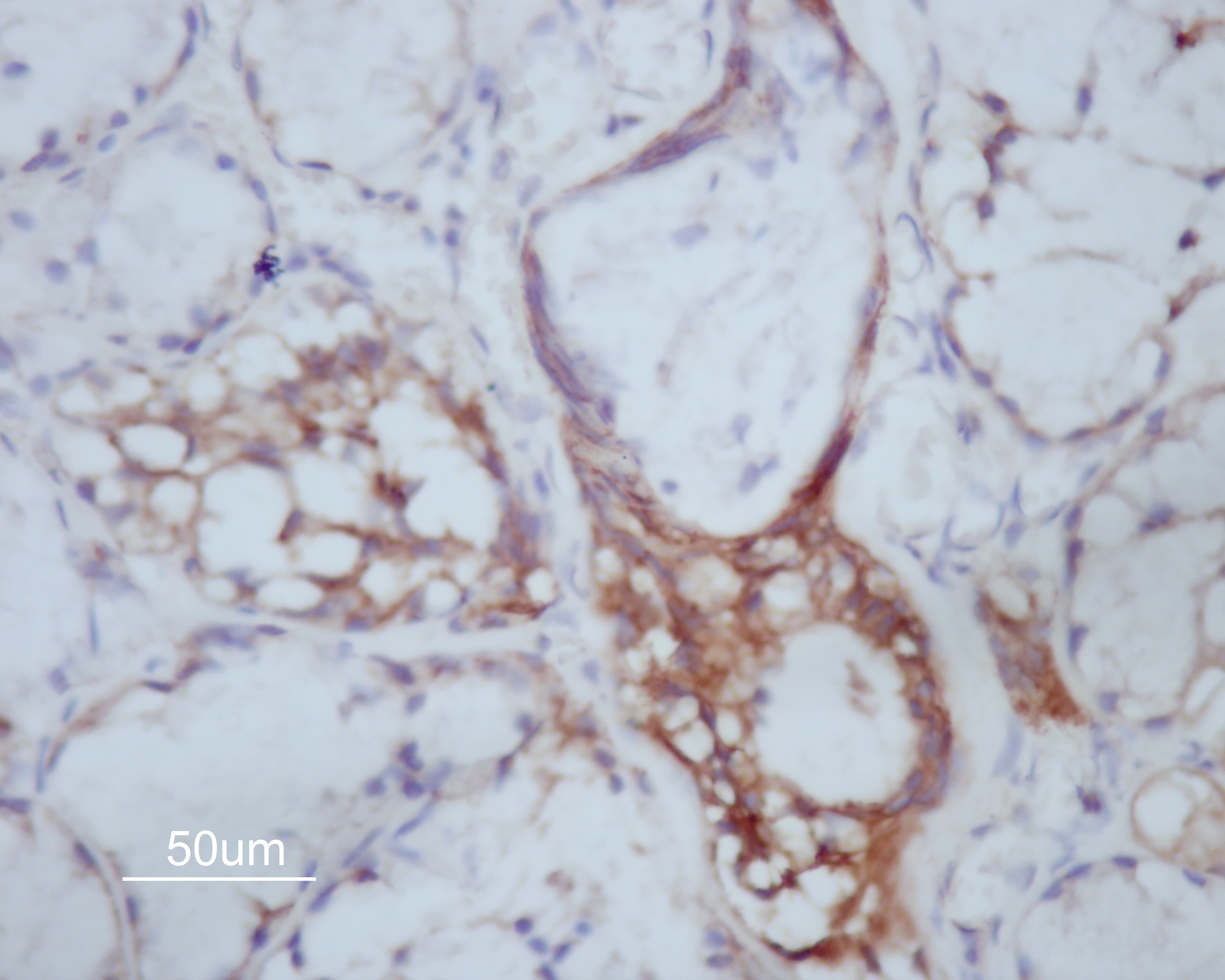 Polyclonal Rabbit anti-Human MMP14 Antibody (IHC, IF, WB)