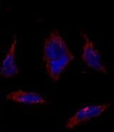 Polyclonal Rabbit anti-Human SOX2 Antibody (aa89-119, IHC, IF, WB)